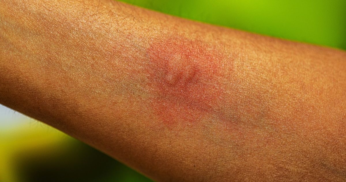 What Is Bitesolgemokz ? – Eine verständliche Einführung