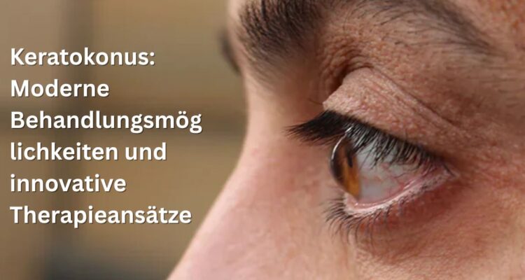 Keratokonus: Moderne Behandlungsmöglichkeiten und innovative Therapieansätze